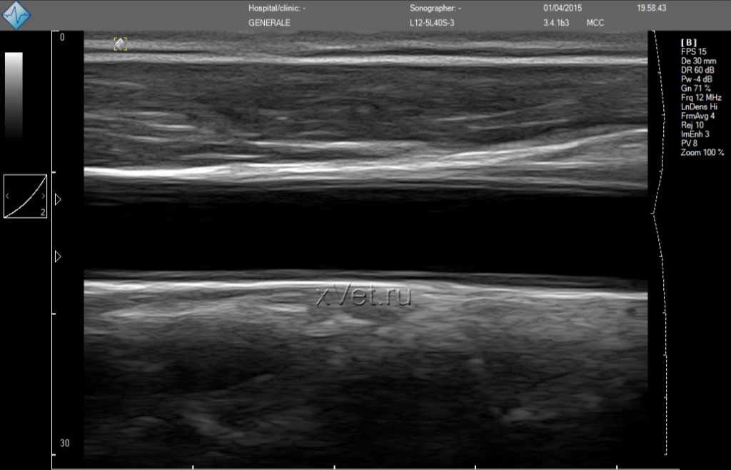micrus_scan_results_2_1038x667.jpg