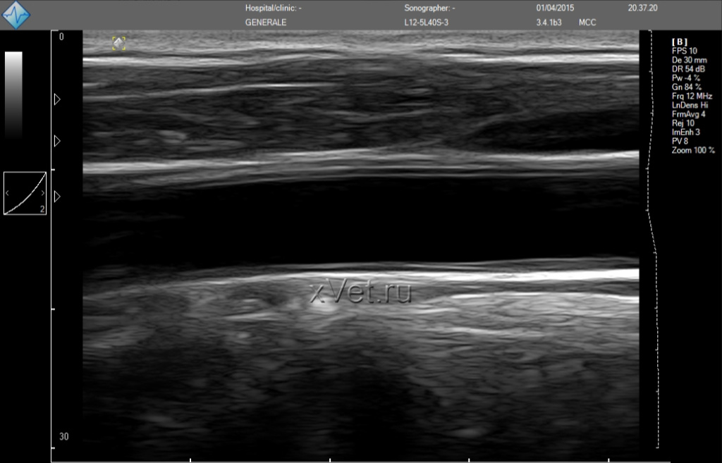 micrus_scan_results_1_1039x667.jpg