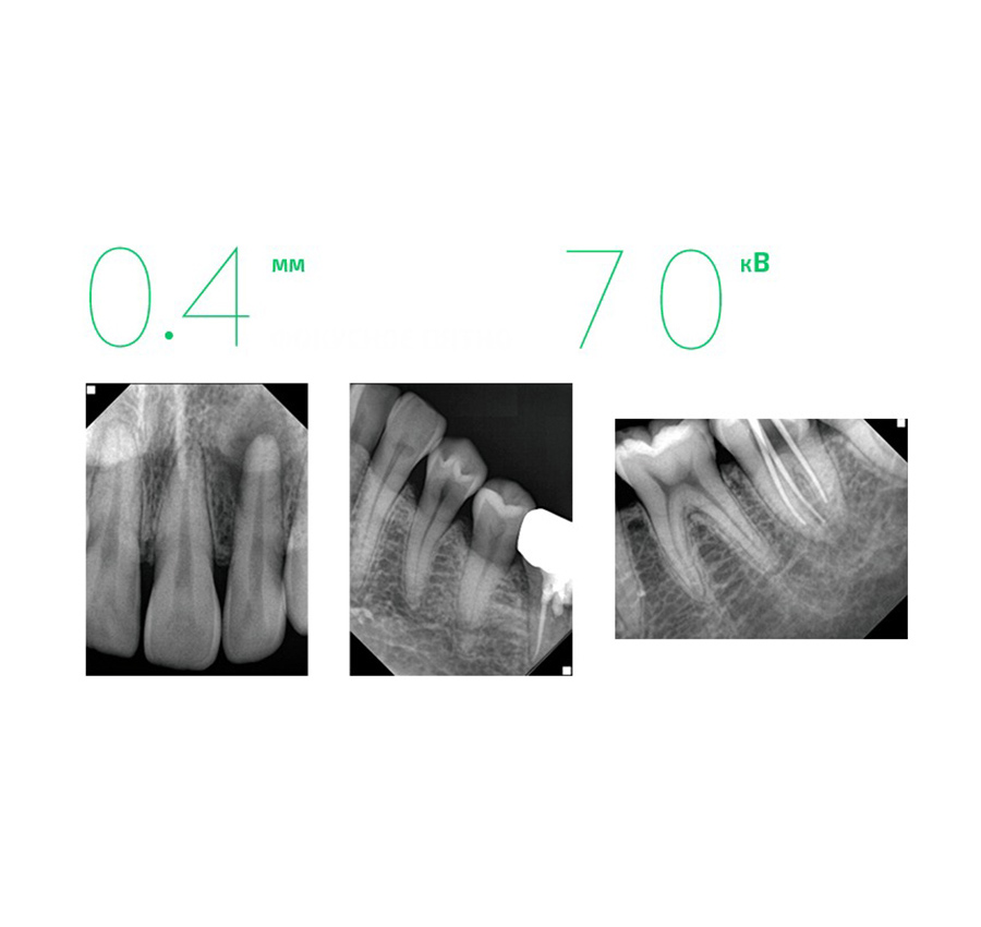 Изображение преимуществ
